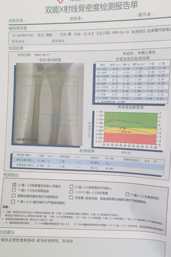 雙能X射線骨密度儀：準(zhǔn)確測量骨密度，助力骨質(zhì)疏松防治，守護(hù)骨骼健康